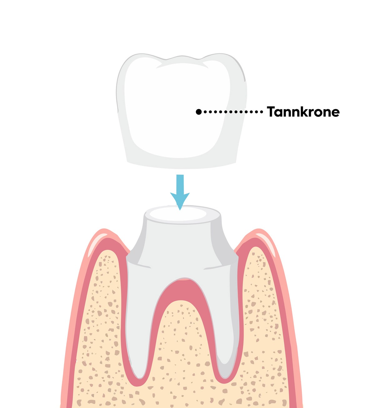 Takrone Takrone