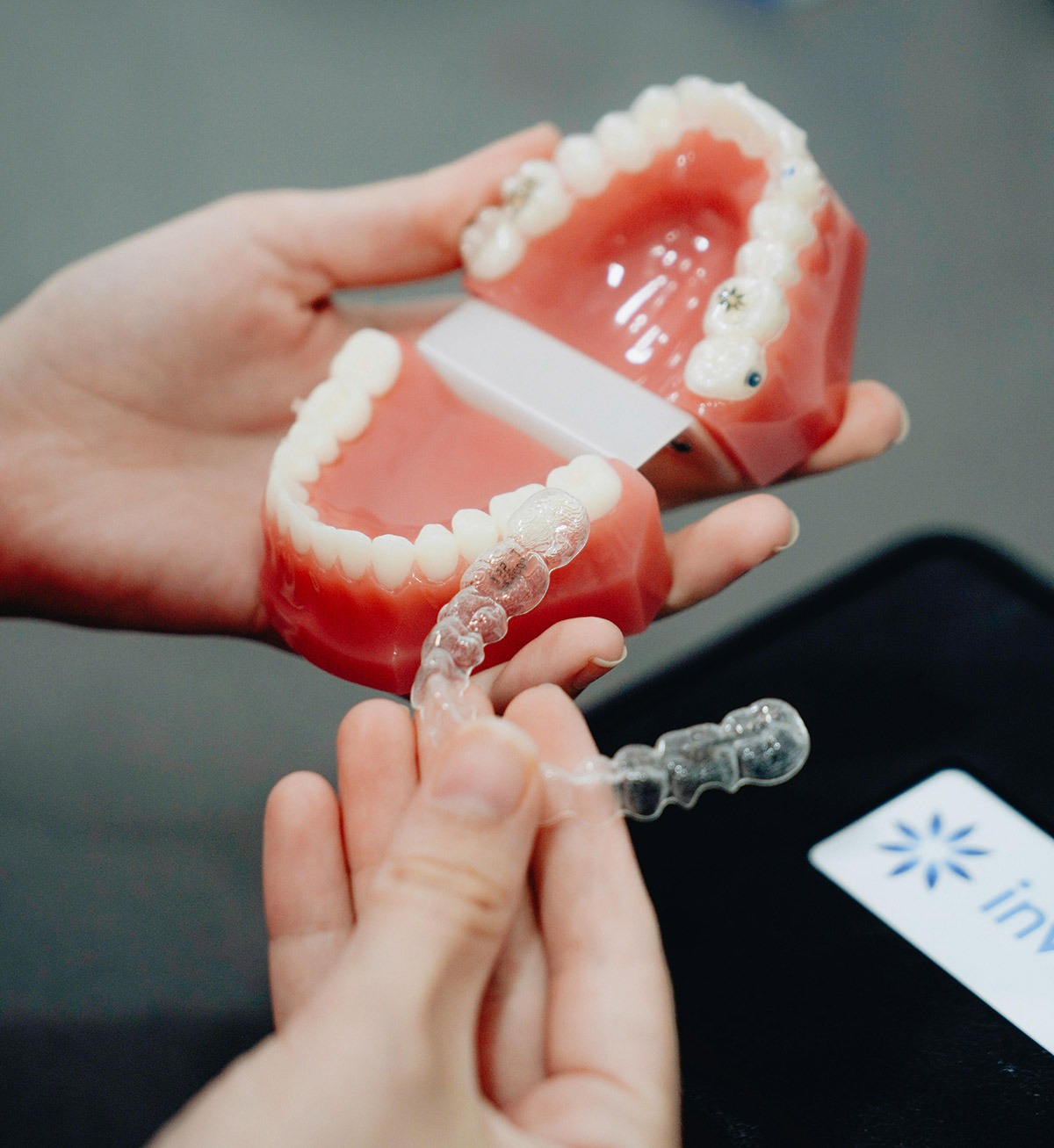 invisalign-model